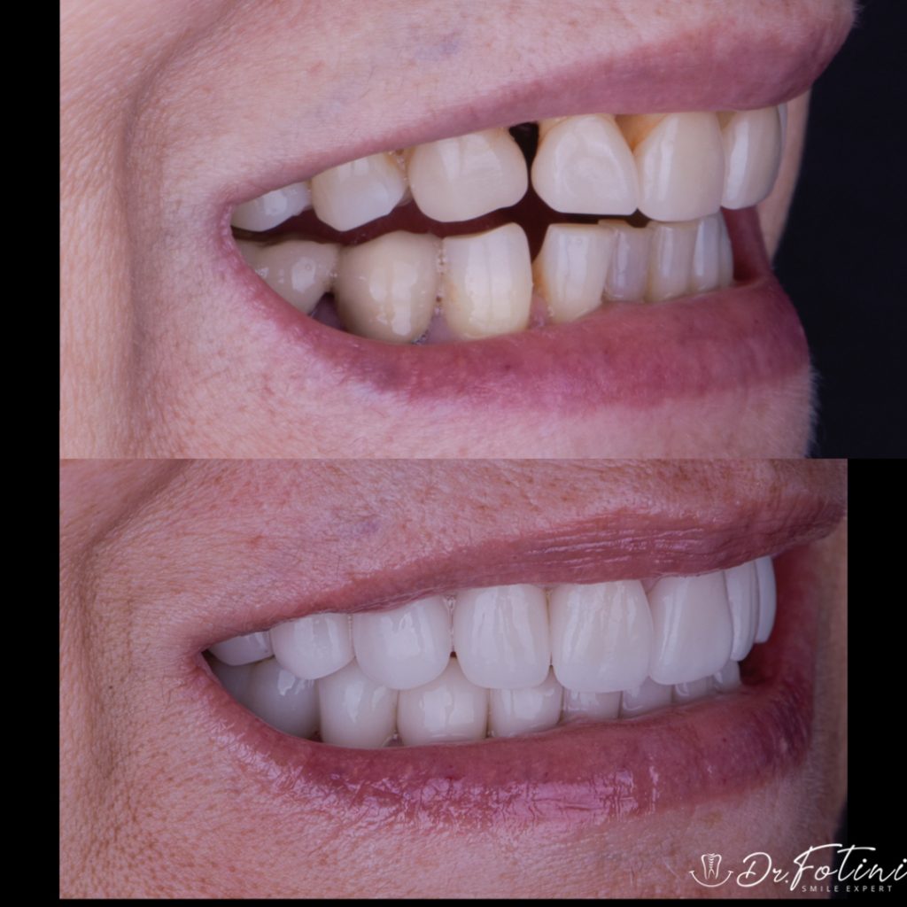 Before After Case 15