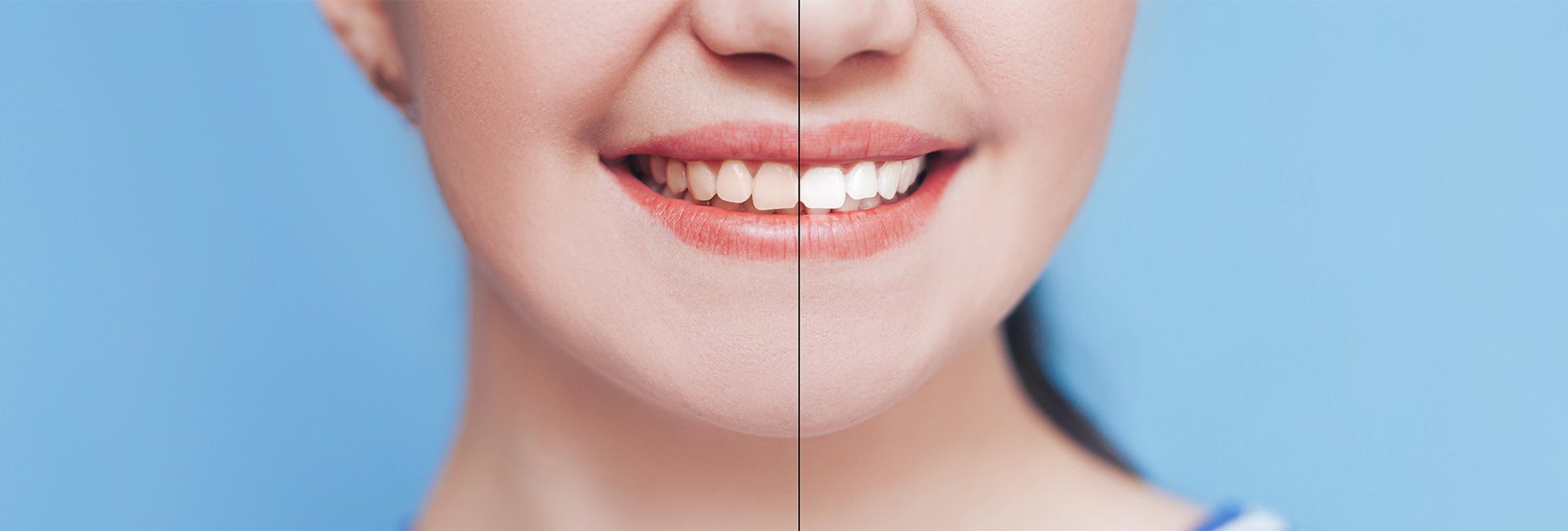 Visualize Your Future Smile with Our AI Tool